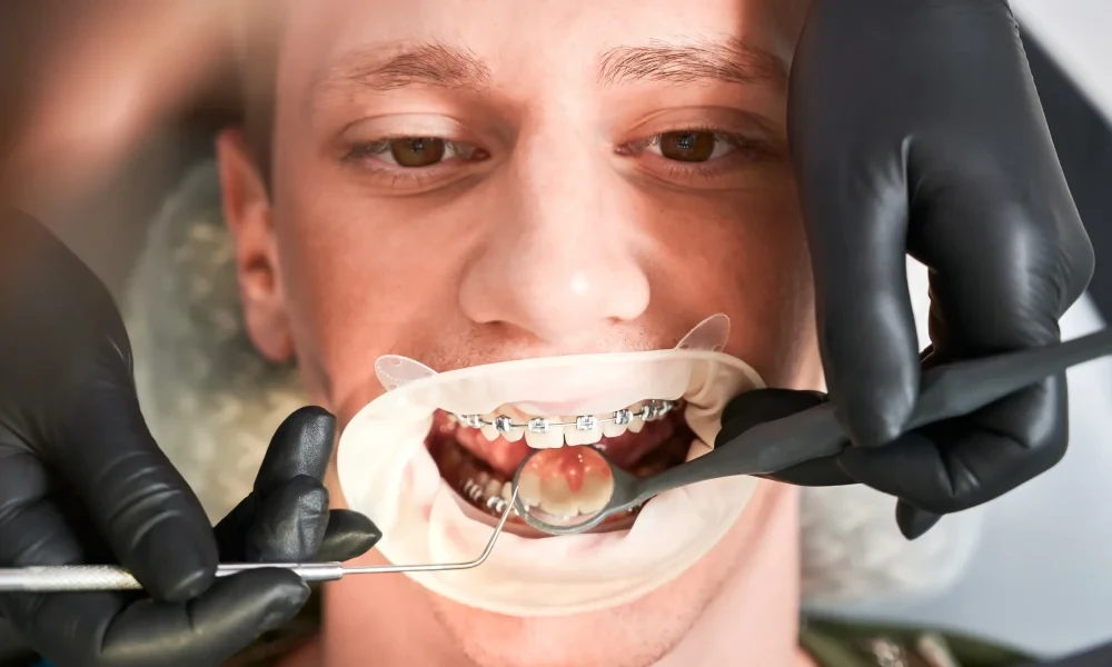 Emergency Dental Treatment And Its Role In Preventing Complications
